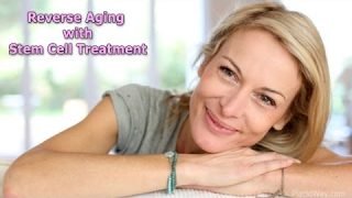 Anti-Aging Stem Cell Treatment and Therapy – Slow Down the Aging