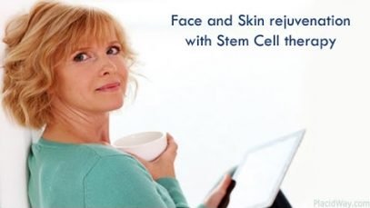Best Anti-Aging Stem Cell Therapy Abroad