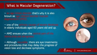 Best Macular Degeneration Treatment in Turkey