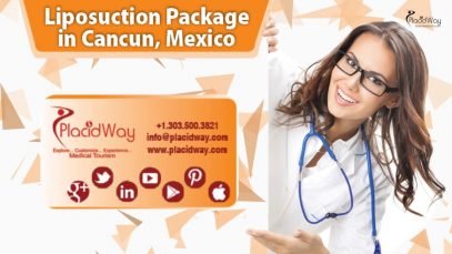 Flawless Liposuction Package in Cancun Mexico
