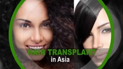 Hair Transplant Procedure in Asia