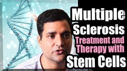 Multiple Sclerosis Treatment with Stem Cells