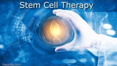 Progencell: Best Stem Cell Therapy in Tijuana, Mexico