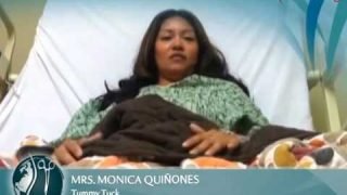 Testimonial: Tummy Tuck Surgery in Mexicali, Mexico