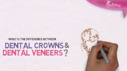 The Difference Between Dental Crowns and Veneers