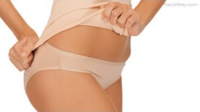 Tummy Tuck Surgery Packages in Mexico