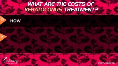 What are the costs of keratoconus treatment?