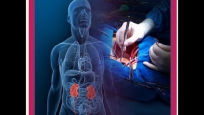 Where Can I Have Kidney Transplant in India?