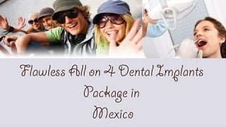All on 4 dental implants package in Mexico