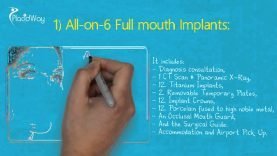 Dental Implants in Los Algodones, Mexico – Cheap All on Six Dental Implants
