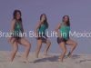 Brazilian Butt Lift in Mexico