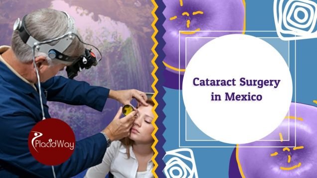 Cataract Surgery in Mexico