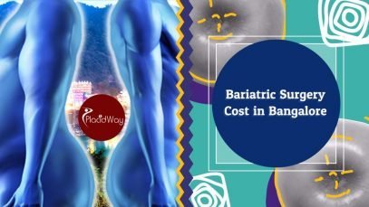 Bariatric Surgery Cost in Bangalore