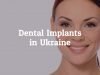 Highly Affordable Dental Implants in Ukraine