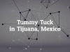 How to Get the Best Tummy Tuck in Tijuana, Mexico