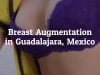 Important Information on Breast Augmentation in Guadalajara, Mexico