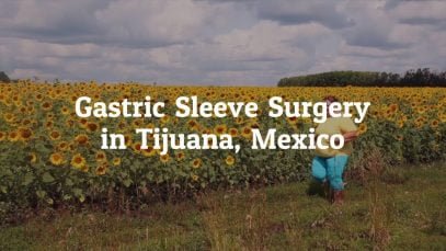 Why Should you Go for Gastric Sleeve Surgery in Tijuana, Mexico?