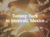 Why You Should Get Tummy Tuck in Mexicali, Mexico?