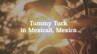 Why You Should Get Tummy Tuck in Mexicali, Mexico?