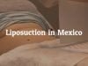 Facts Related to Liposuction in Mexico