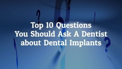 Top 10 Questions You Should Ask A Dentist Before Going For Dental Veneers In Costa Rica