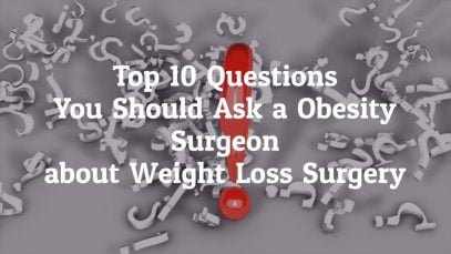 What Are The Top 10 Questions You Should Ask An Obesity Surgeon Before Going For Weight Loss Surgery In Mexico?