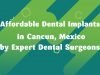 Affordable Dental Implants in Cancun, Mexico by Expert Dental Surgeons