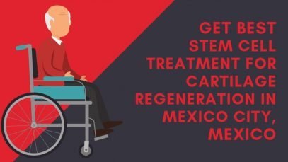Get Best Stem Cell Treatment for Cartilage Regeneration in Mexico City, Mexico