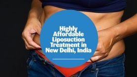 Highly Affordable Liposuction Treatment in New Delhi, India