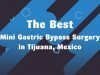 The Most Affordable Mini Gastric Bypass Surgery in Cancun, Mexico