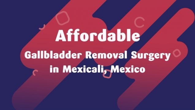 Affordable Gallbladder Removal Surgery in Mexicali, Mexico