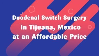 Duodenal Switch Surgery in Tijuana, Mexico at an Affordable Price