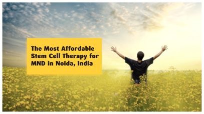 The Most Affordable Stem Cell Therapy for MND in Noida, India