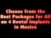 Choose from the Best Packages for All on 4 Dental Implants in Mexico