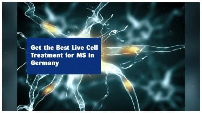 Get the Best Live Cell Treatment for MS in Germany