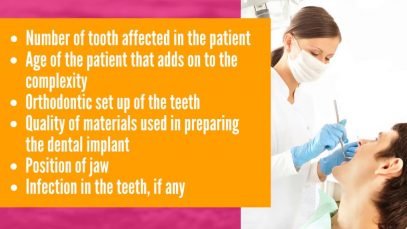 Effective Package for All on 4 Dental Implants in Mexicali, Mexico