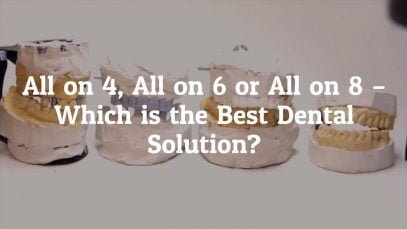 All on 4, All on 6 or All on 8 – Which is the Best Dental Solution?