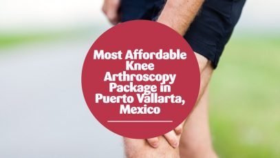 Most Affordable Knee Arthroscopy Package in Puerto Vallarta, Mexico