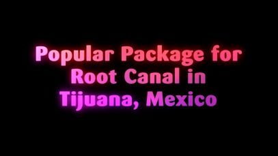 Popular Package for Root Canal in Tijuana, Mexico
