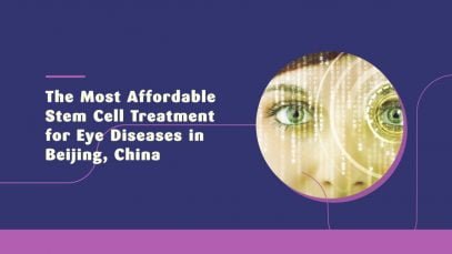 The Most Affordable Stem Cell Treatment for Eye Diseases in Beijing, China