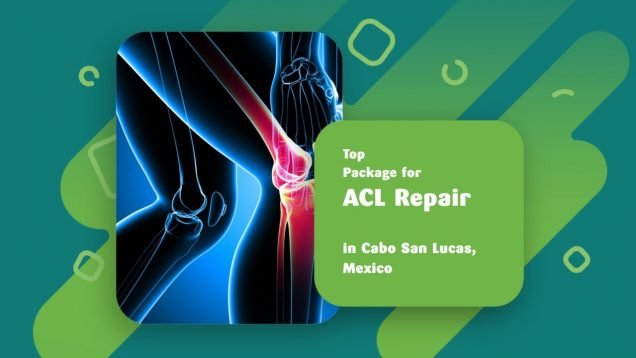 Top Package for ACL Repair in Cabo San Lucas, Mexico