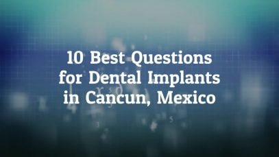 10 Best Questions to Ask Before Going For Dental Implants in Cancun, Mexico