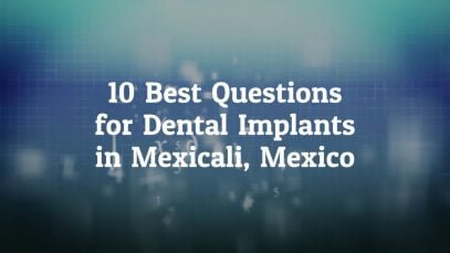 10 Best Questions to Ask Before Going For Dental Implants in Mexicali, Mexico