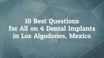 10 Best Questions to Ask before All on 4 dental implants in Los Algodones, Mexico