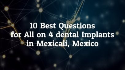 10 Best Questions to Ask before Going for All on 4 dental implants in Mexicali, Mexico