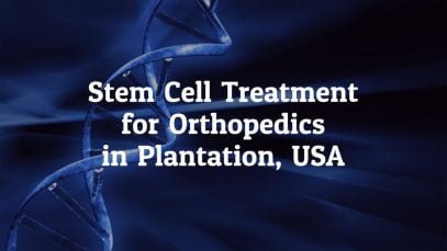 Best Information on Stem Cell Treatment for Orthopedics in Plantation, USA