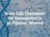 Find Top Stem Cell Treatment for Osteoarthritis in Tijuana, Mexico
