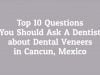 Top 10 Questions to Ask a Dentist Before Dental Veneers in Cancun, Mexico