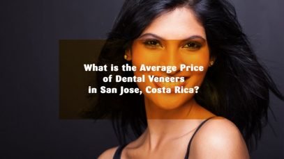 What is the Average Price of Dental Veneers in San Jose, Costa Rica?