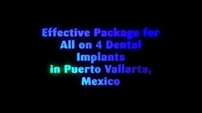 Effective Package for All on 4 Dental Implants in Puerto Vallarta, Mexico